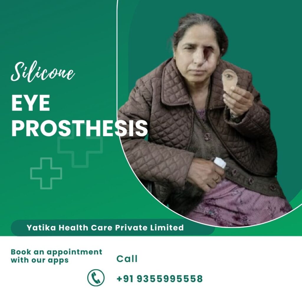 eye prosthesis
