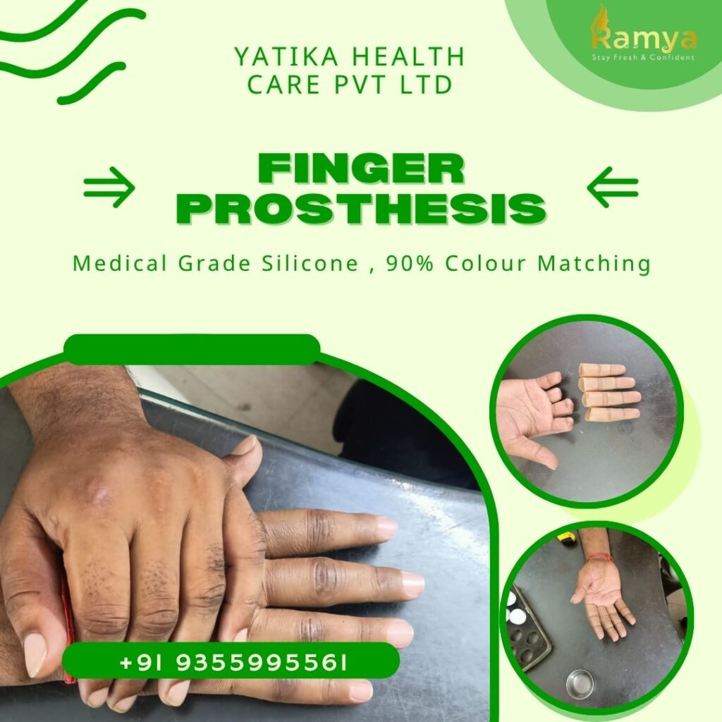 Finger Prosthesis