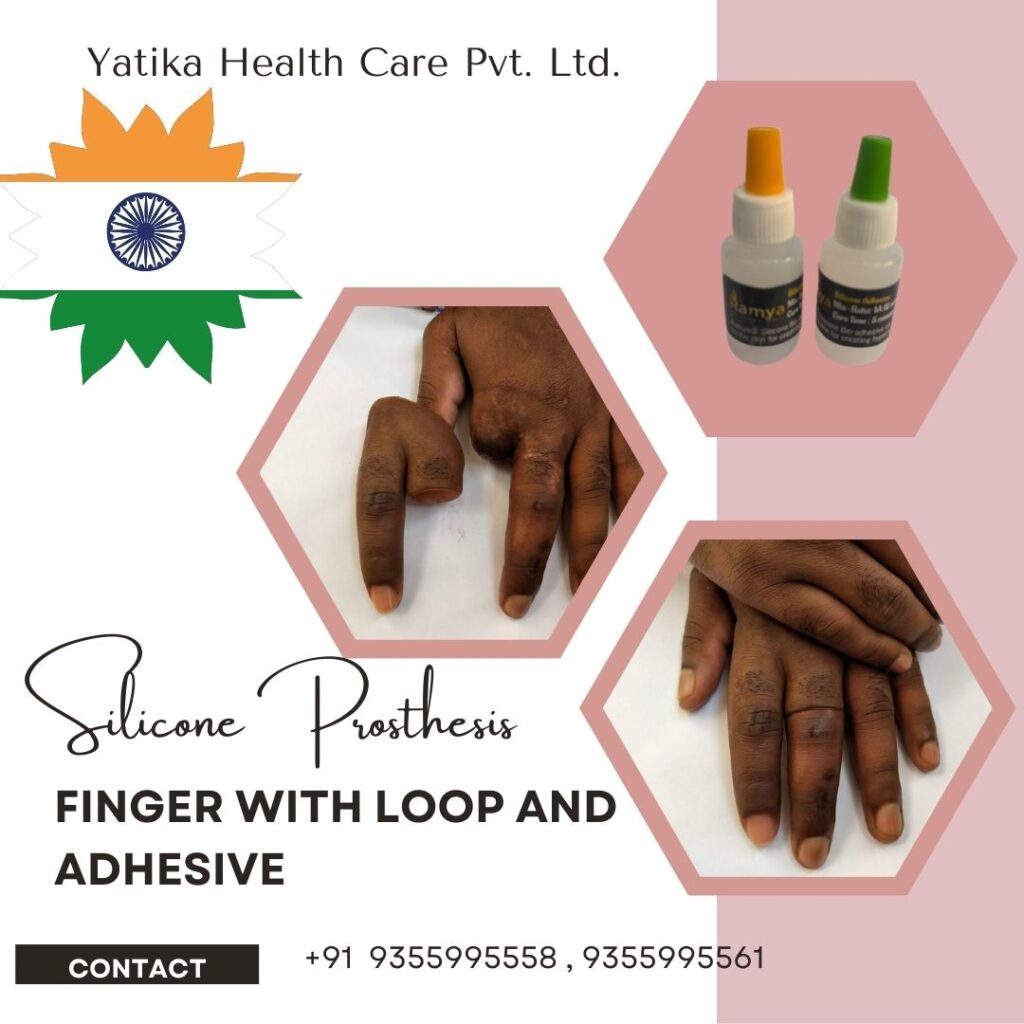 finger with loop and adhesive