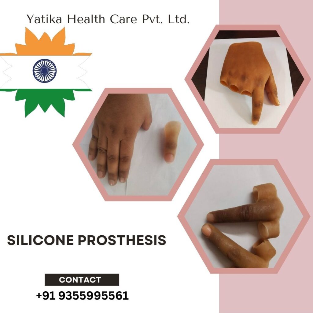 silicone prosthesis (2)