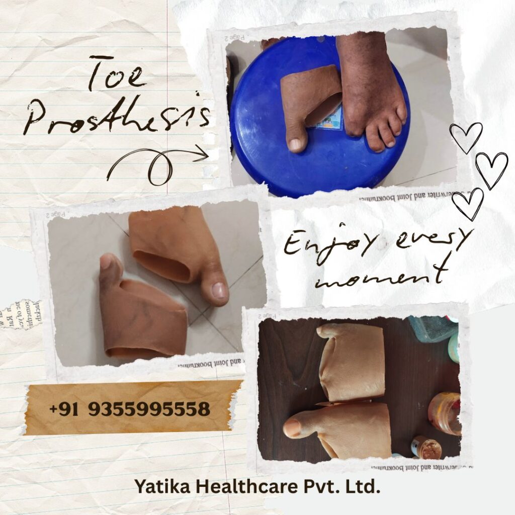 toe prosthesis