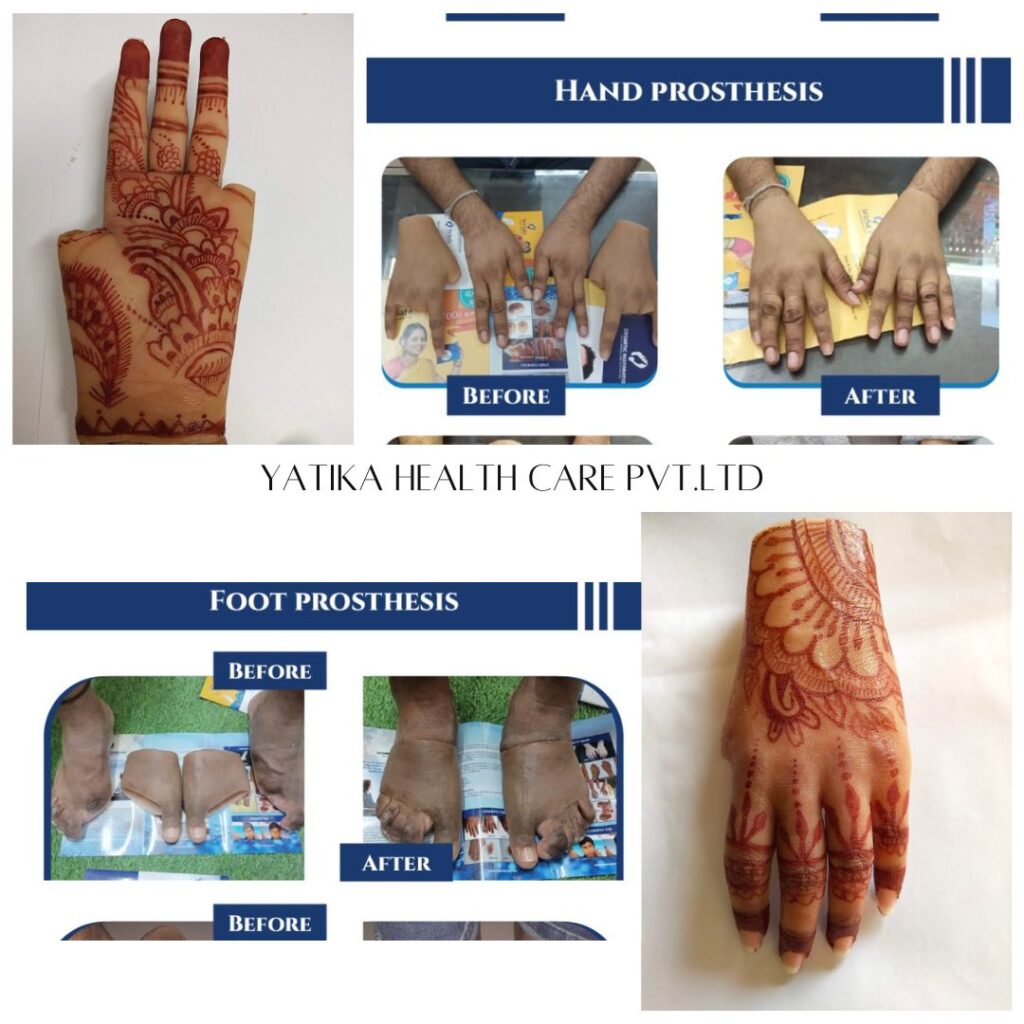 yatika health care pvt. ltd